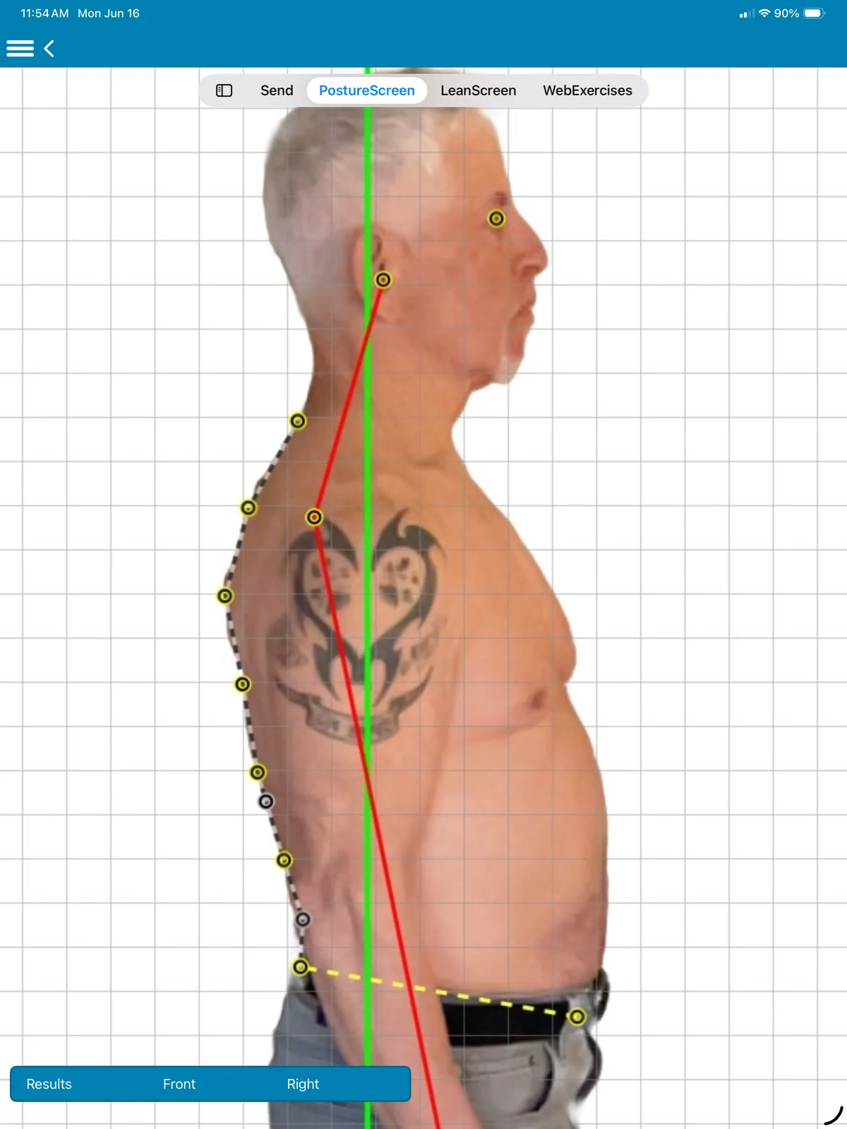 A right lateral posture view on iPad: a man’s side view on a grid with landmark points along the spine and from ear to ankle, the red posture line and the green plumb line.