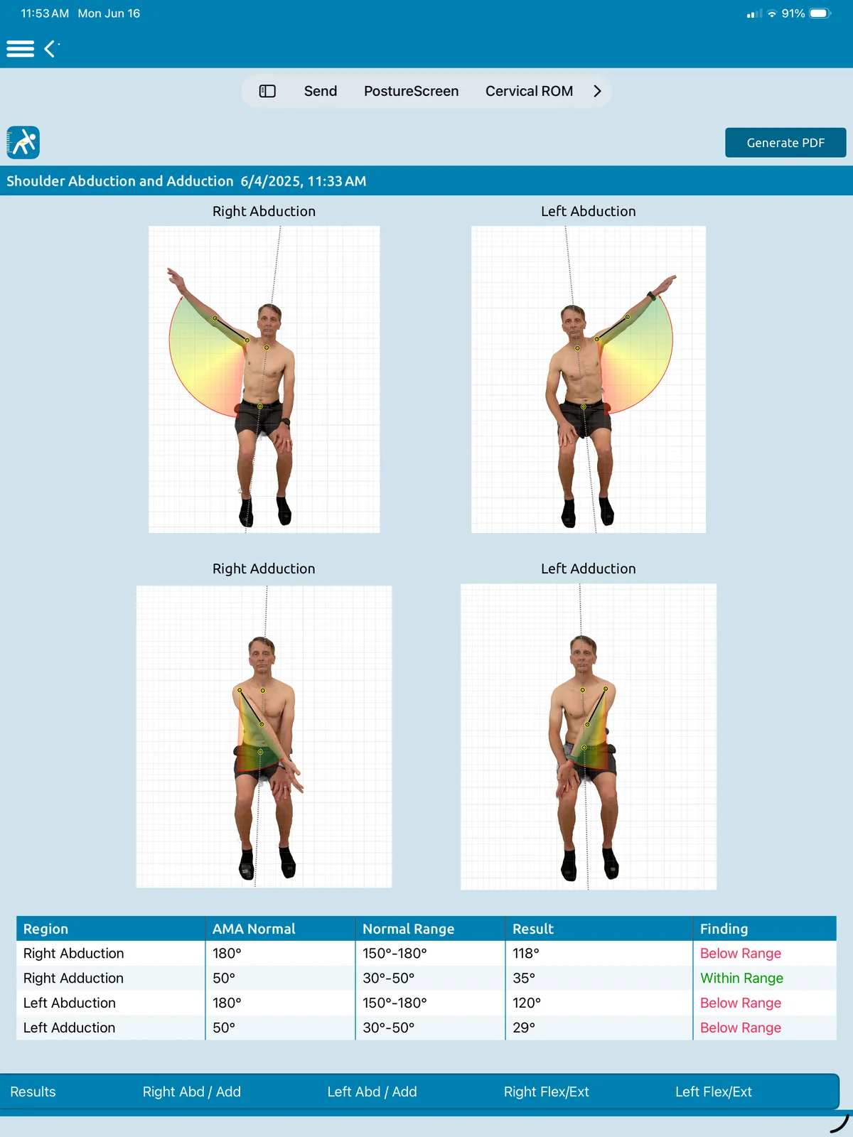 Shoulder range of motion results on iPad: right and left abduction and adduction photos with coloured angle wedges, above a table of each motion with its normal range, result and finding, and a Generate PDF button.