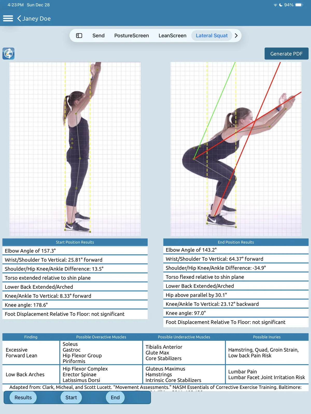 SquatScreen lateral overhead squat on iPad with red and green lines and a findings table.
