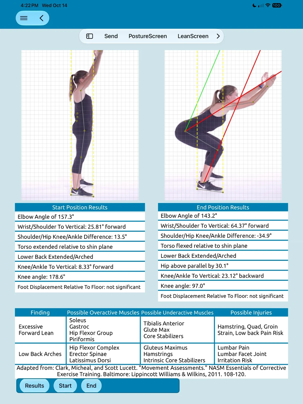 SquatScreen lateral overhead squat results on iPad: start and end photos from the side with landmark points and lines, start and end position results such as elbow and knee angles, hip above parallel and lower back arched, and a findings table for excessive forward lean and low back arches with possible overactive and underactive muscles.