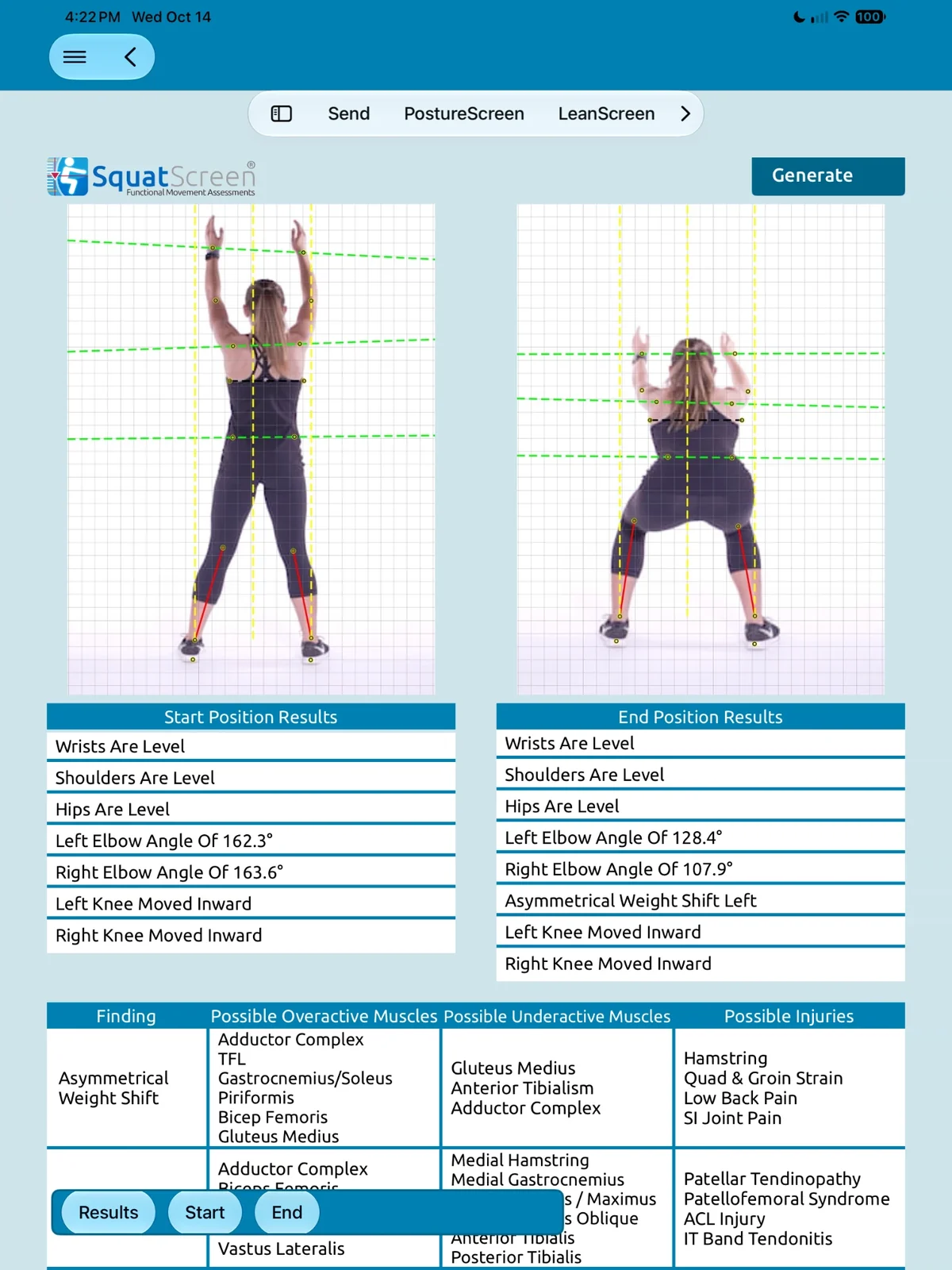 SquatScreen posterior (PA) overhead squat results on iPad: start and end photos from behind on a grid with landmark points and lines, start and end position results such as elbow angles, asymmetrical weight shift left and knees moved inward, and a findings table with possible overactive and underactive muscles.
