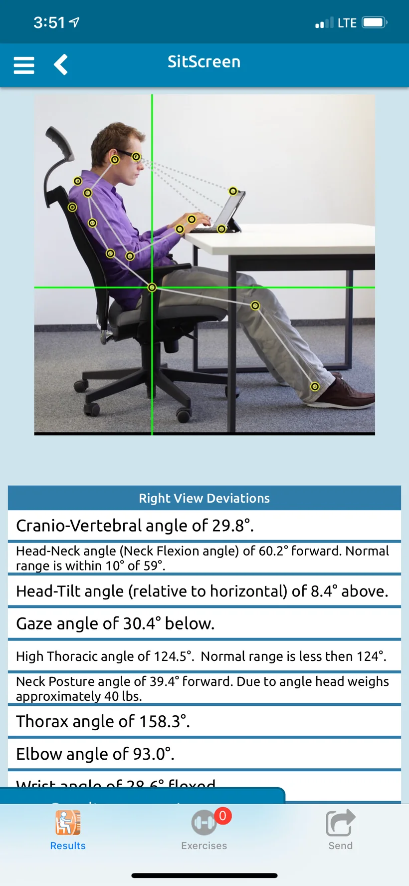 SitScreen on iPhone: a man at a laptop in side view with landmark points, angle lines and a gaze line to the screen, above Right View Deviations such as cranio-vertebral angle, head-neck angle, head-tilt, gaze, high thoracic, neck posture, thorax and elbow angles.