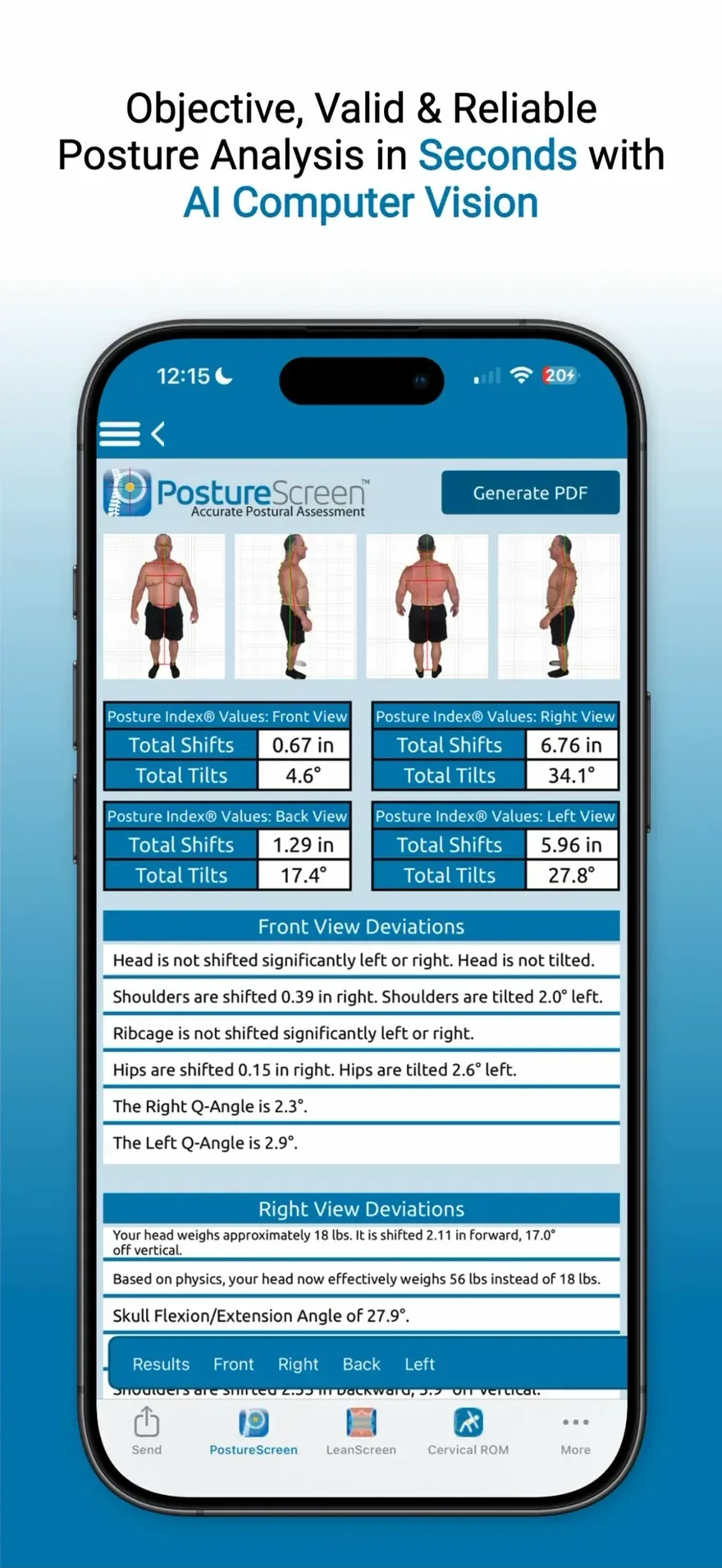 Objective, Valid & Reliable Posture Analysis in Seconds with AI Computer Vision