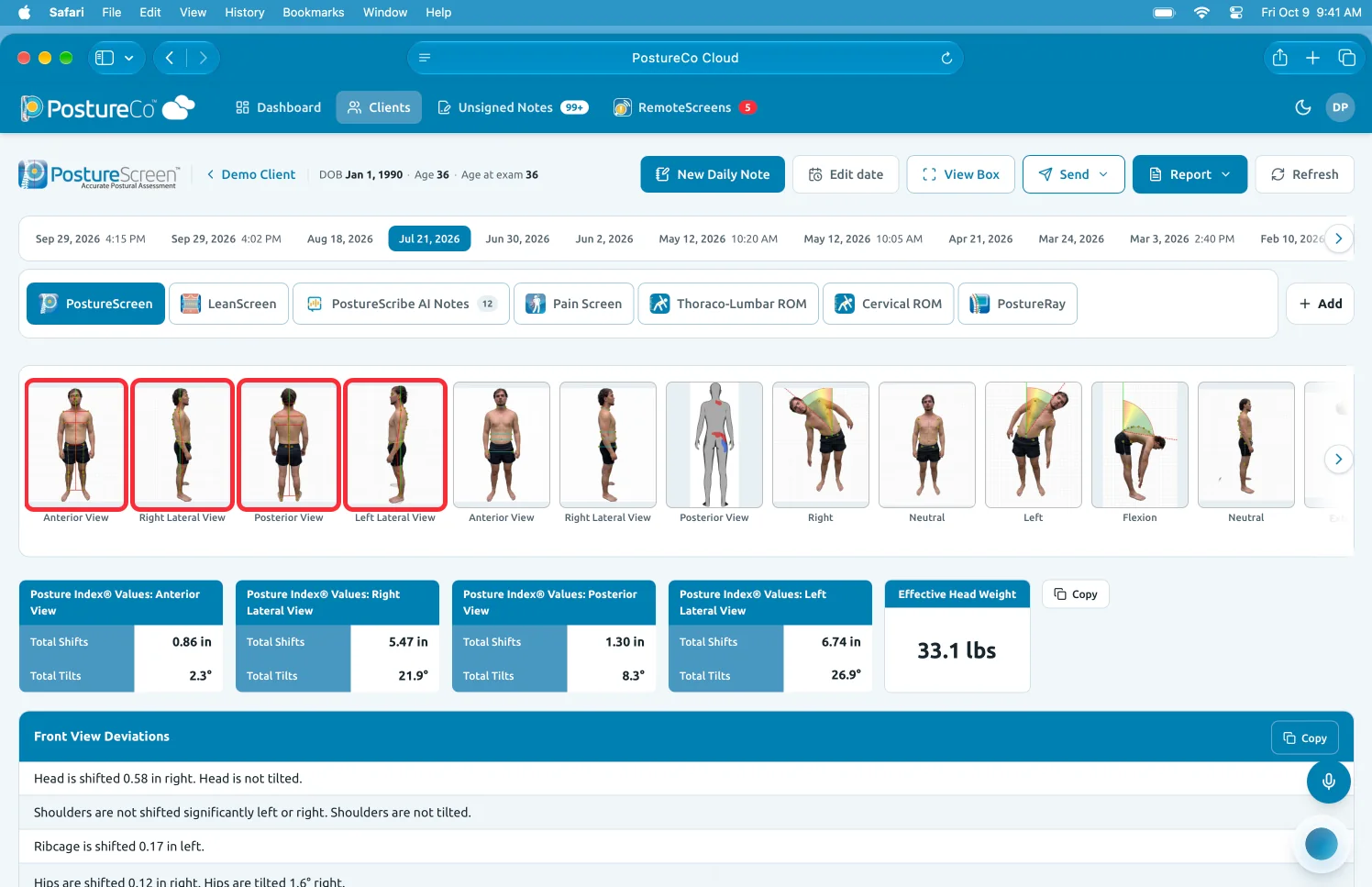Preview: a demo client’s record with every exam by date, module tabs and Posture Index values for four views.