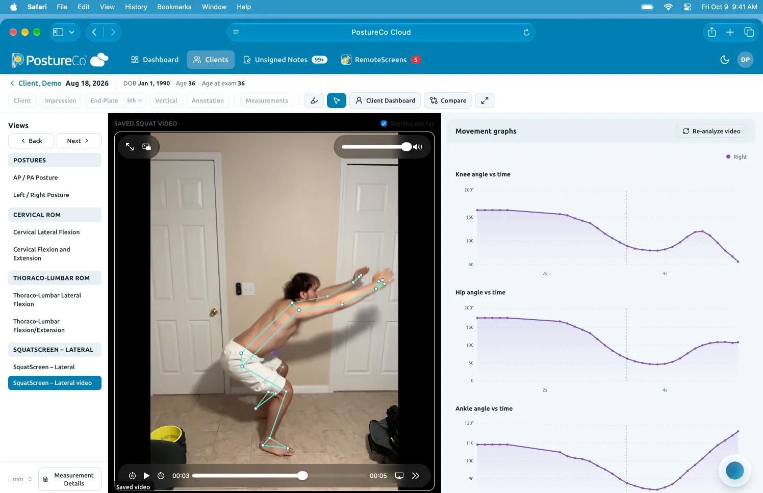 Preview: a SquatScreen lateral video with a skeletal overlay beside knee, hip and ankle angle graphs.
