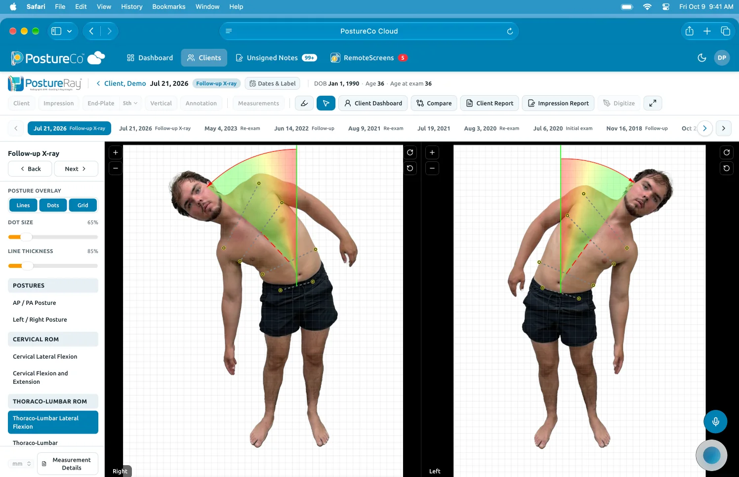 Preview: two posture photos side by side with line, dot and grid overlays.