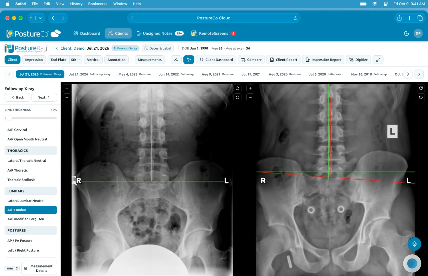 Preview: two lumbar X-ray views in the client’s record.