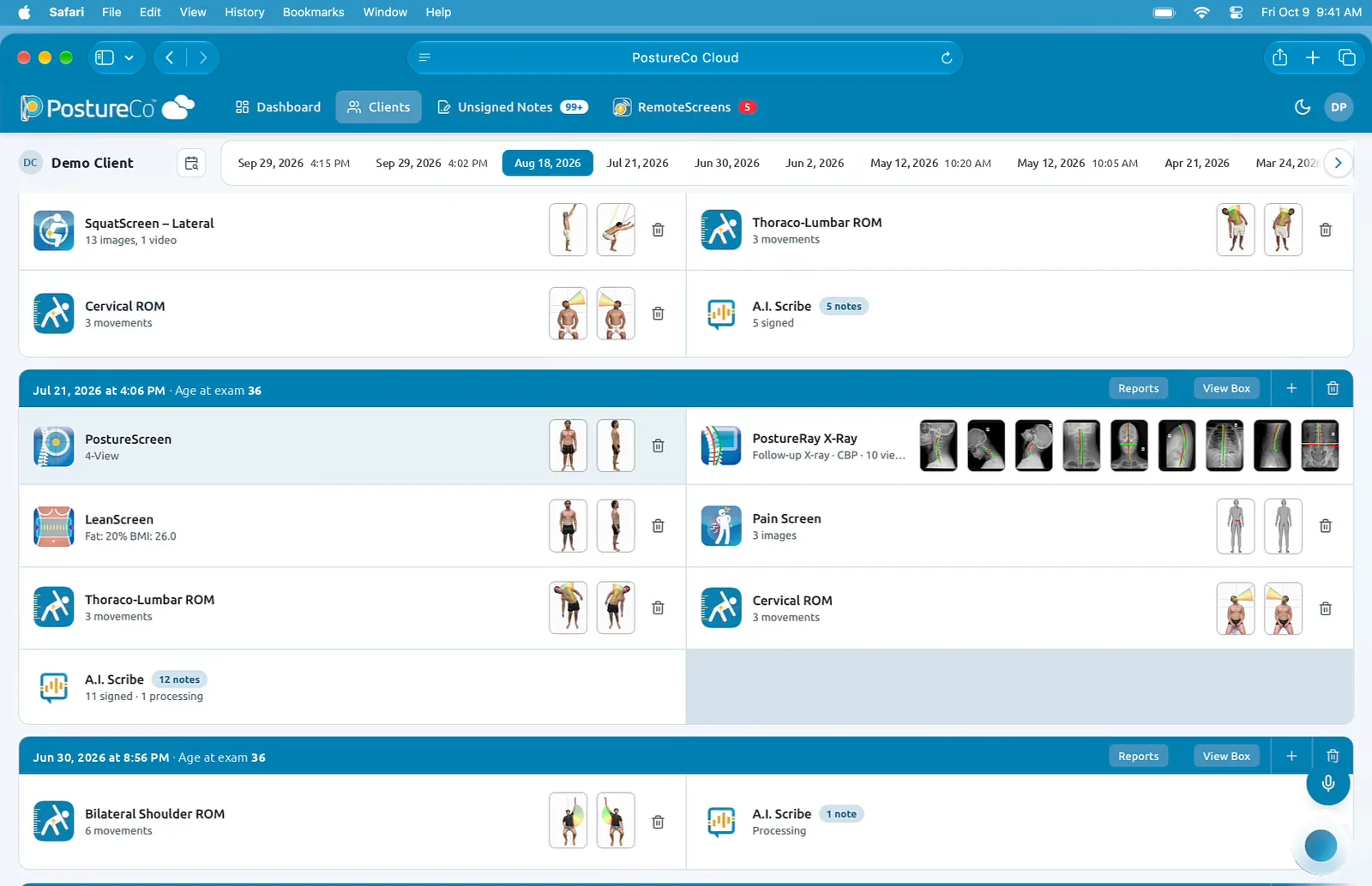Preview: a demo client’s exams on one timeline by date, with RemoteScreens waiting in the PostureCo Cloud header.