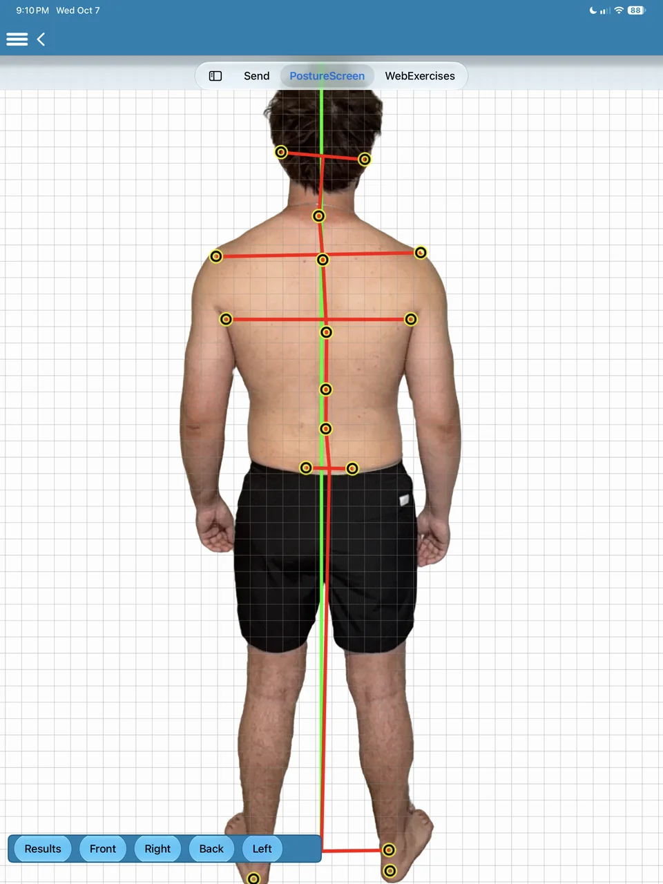 Back view with shoulder and hip level lines and a spinal line.