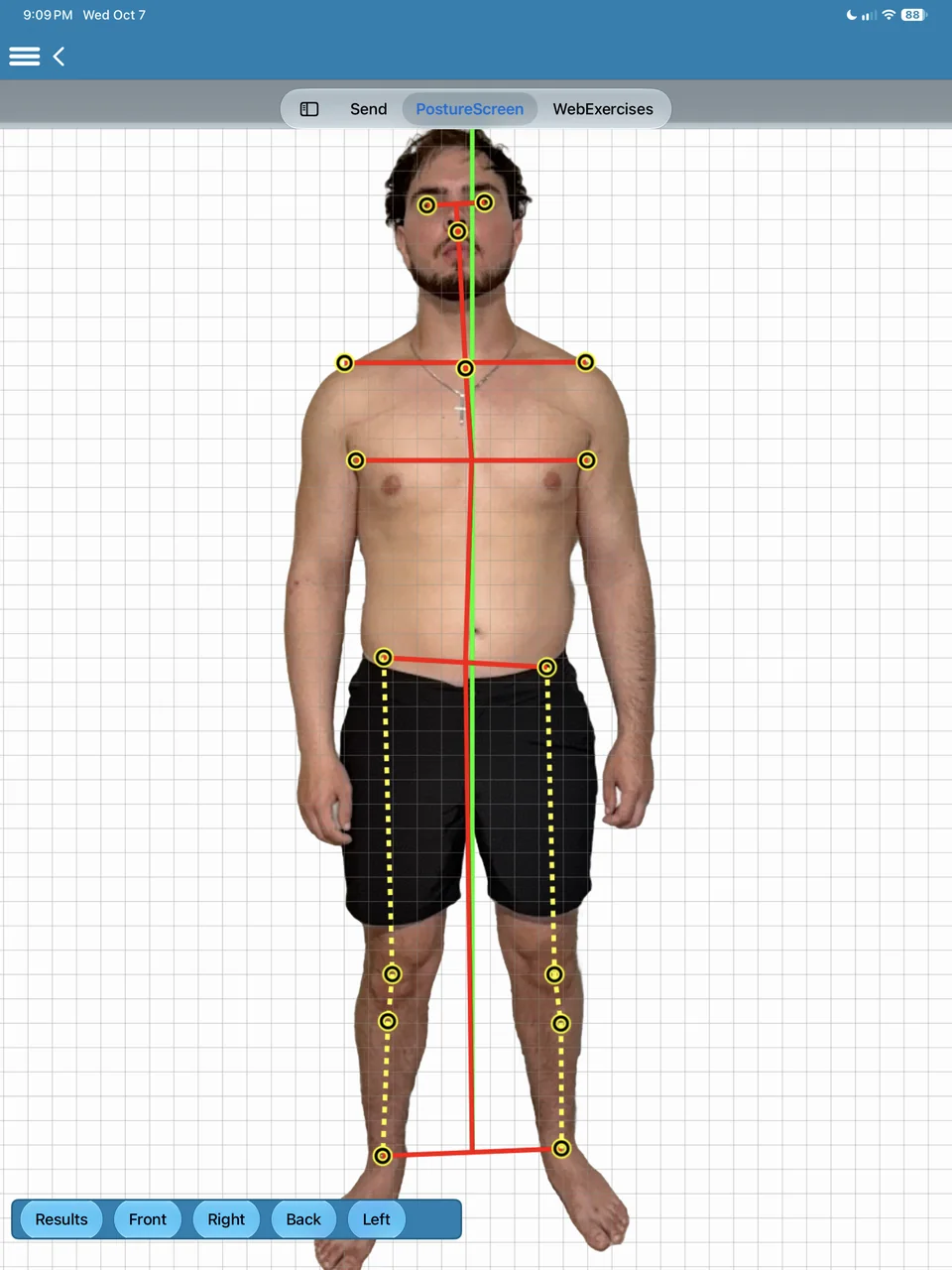 Front view with landmarks at the head, shoulders, hips, knees and ankles, level lines and a plumb line.