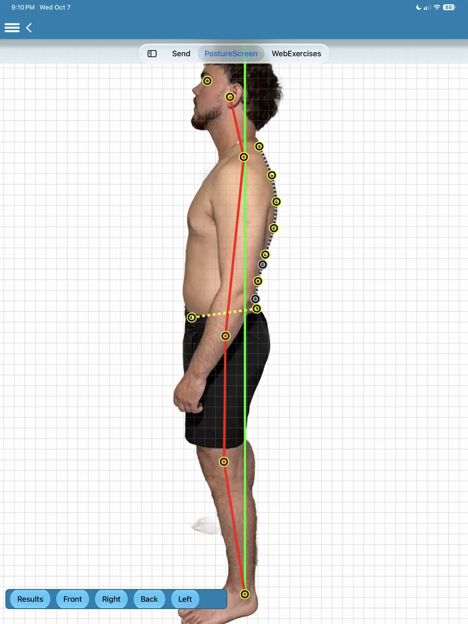 Left side view with landmarks along the spine, the posture line and the plumb line.