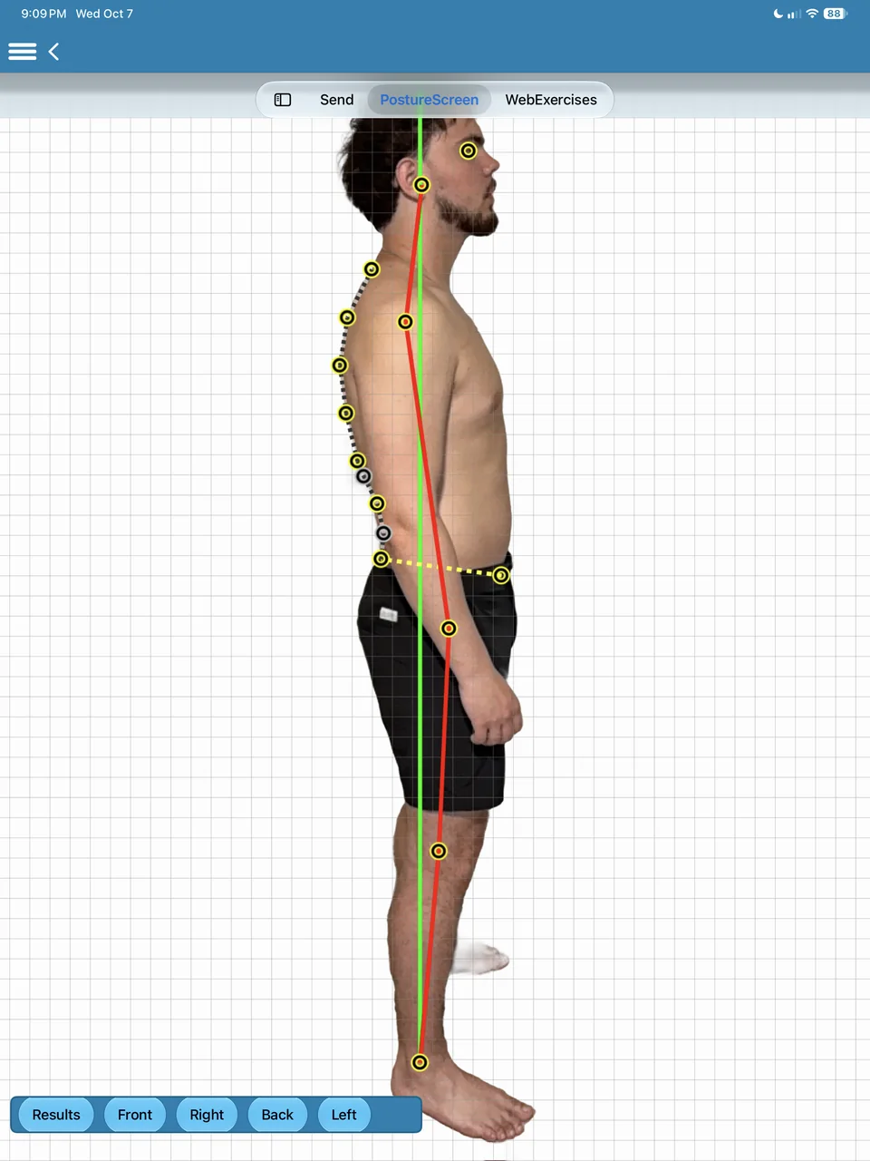 Right side view with landmarks from ear to ankle, the posture line and the plumb line.