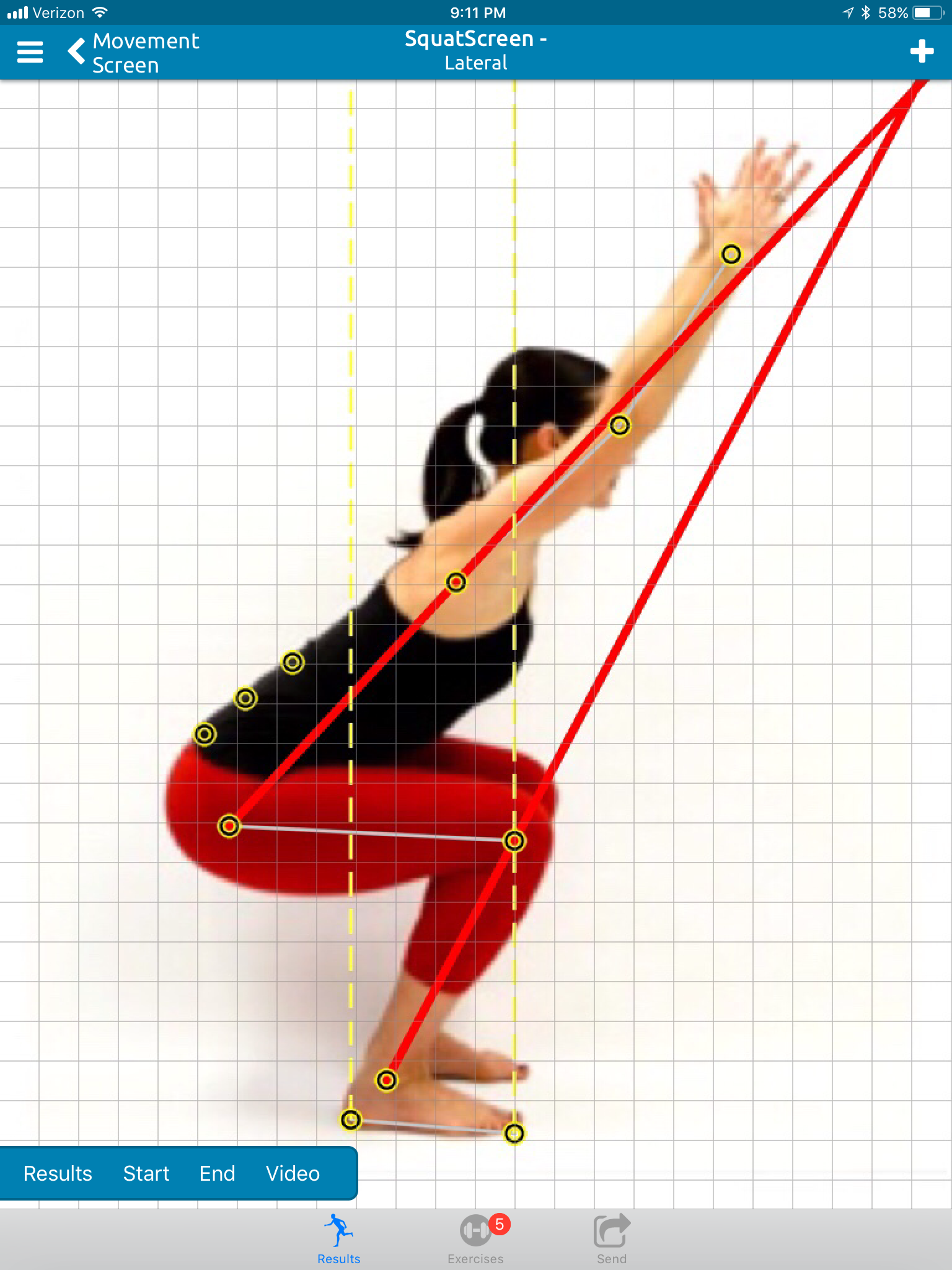 Posturescreen Uses Augmented Reality Assisted Posture Analysis For