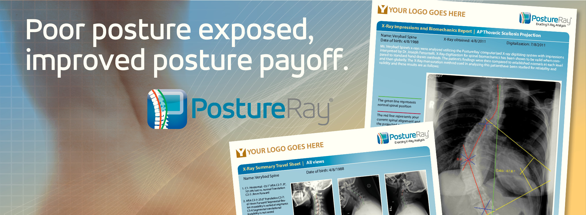 PostureCo Website Rotators 20165